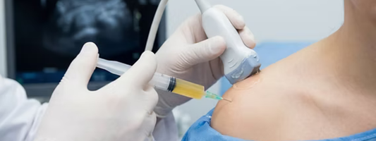 PRP Preparation Guide Improve Your Results Before Treatment