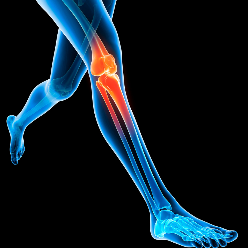 blue knee anatomy graphic on black background orthopedic surgery information for patients dr reza jazayeri md orthopedic surgeon