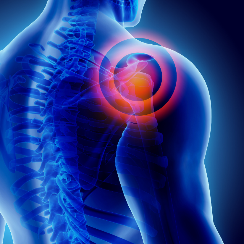 shoulder dr reza jazayeri md orthopedic surgeon patient education resource 