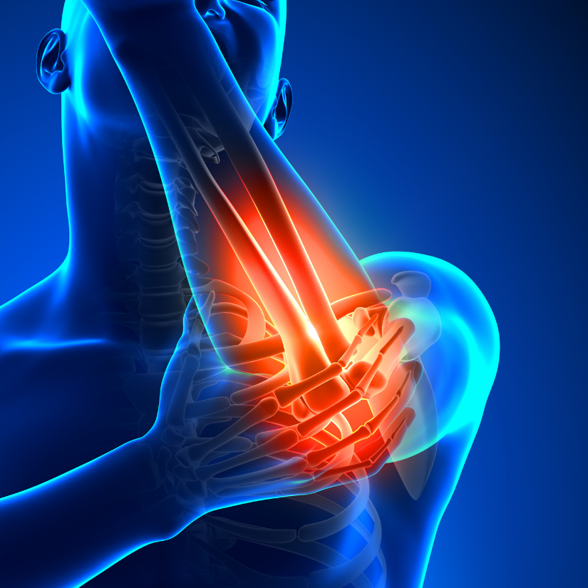 elbow orthopedic surgery patient information from dr reza jazayeri md orthopedic surgeon