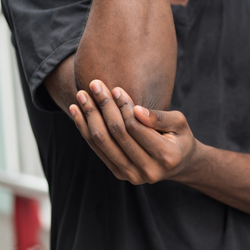 african man suffering from elbow pain; sick black man with elbow joint pain, osteoporosis, bone arthritis, gout, symptoms; body sickness, health care or pain concept; adult african man or model