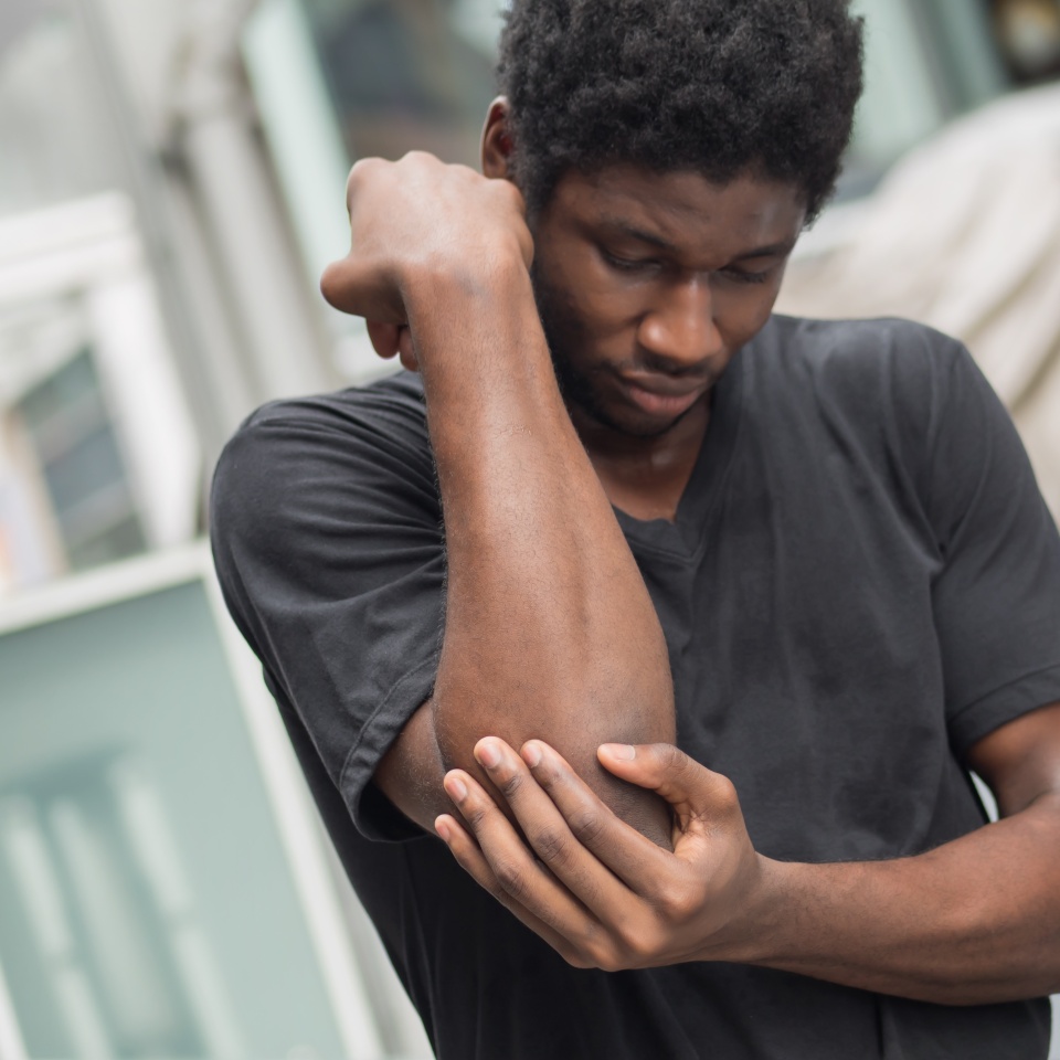 african man suffering from elbow pain; sick black man with elbow joint pain, osteoporosis, bone arthritis, gout, symptoms; body sickness, health care or pain concept; adult african man or model