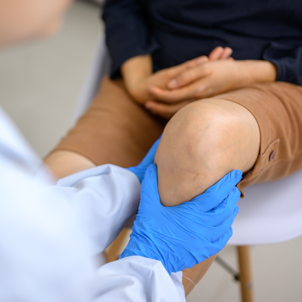 A doctor is examining the knee of a woman who has a knee injury. Foot treatment with an orthopedic surgeon will treat pain caused by running or exercising incorrectly