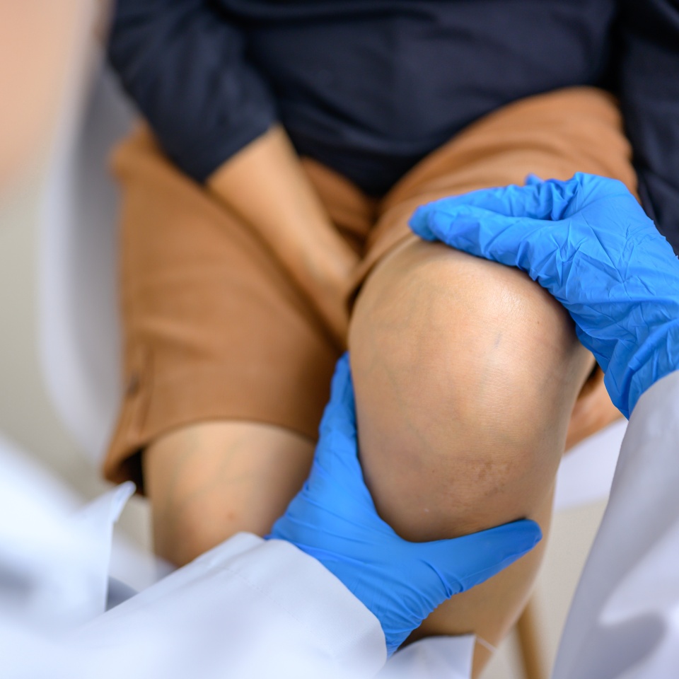 Close-up picture of an orthopedic doctor wearing medical gloves An orthopedic doctor examines a patient's knee joint to analyze the cause of osteoarthritis in his office at the hospital.