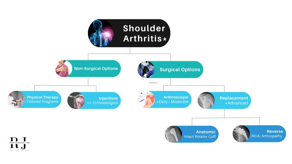 Flowchart for shoulder arthritis treatment options: Non-surgical (physical therapy, injections) and surgical (arthroscopic for early/moderate, replacement—anatomic or reverse—for advanced cases).