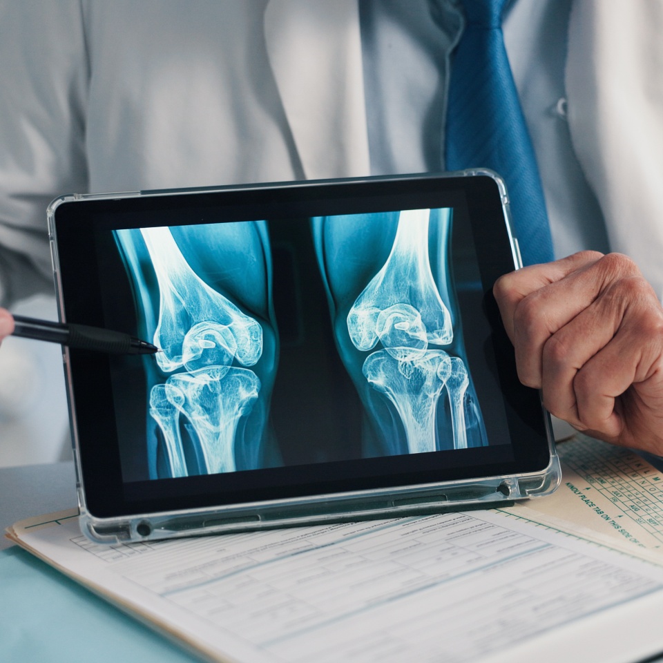 Hands, screen and tablet for x ray with knee, scan or osteoporosis with point at hospital. Doctor, application and ux for medical consultation for arthritis, feedback or report for wellness at clinic.