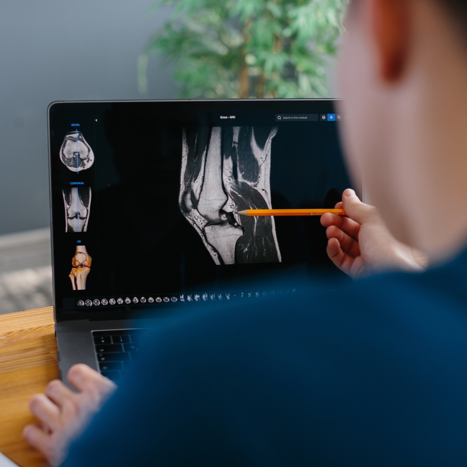 Medical professional examining knee mri images on a laptop, pointing with a pencil, discussing patient diagnosis