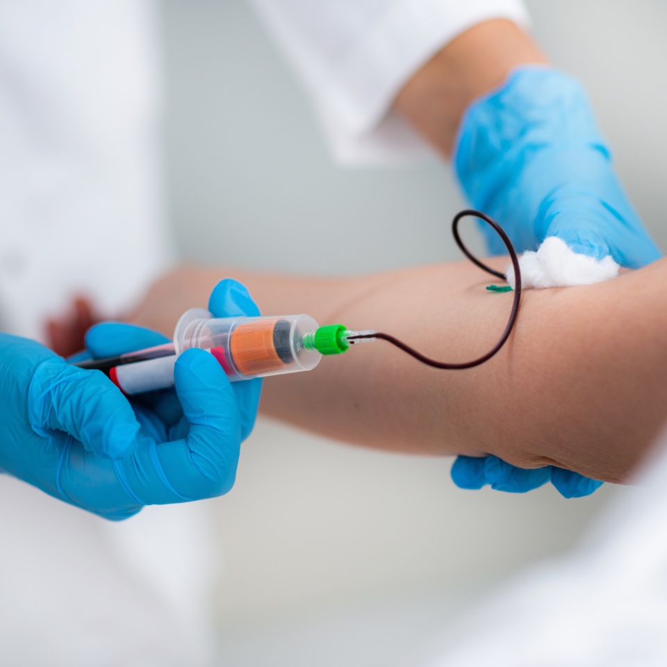 PRP Treatment. Drawing Blood for Platelet Rich Plasma Injection, Aesthetic Medicine Treatment for Reduction of Face Wrinkles.